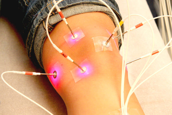 Laserakupunktur des Knies